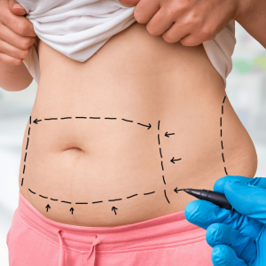 plastic surgeon dr pratap nadar